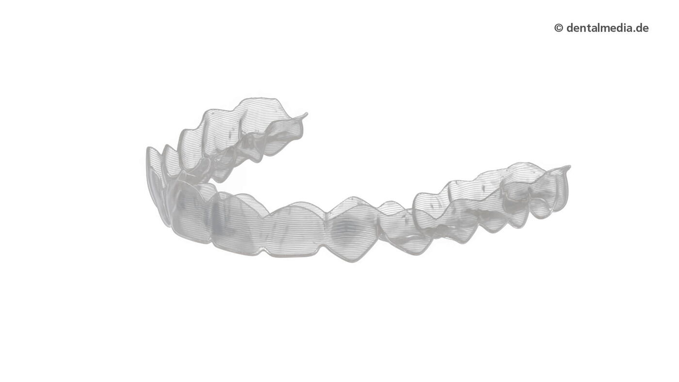 JOLA Aligner ist die herausnehmbare Zahnspange, um Zahnfehlstellungen zu korrigieren