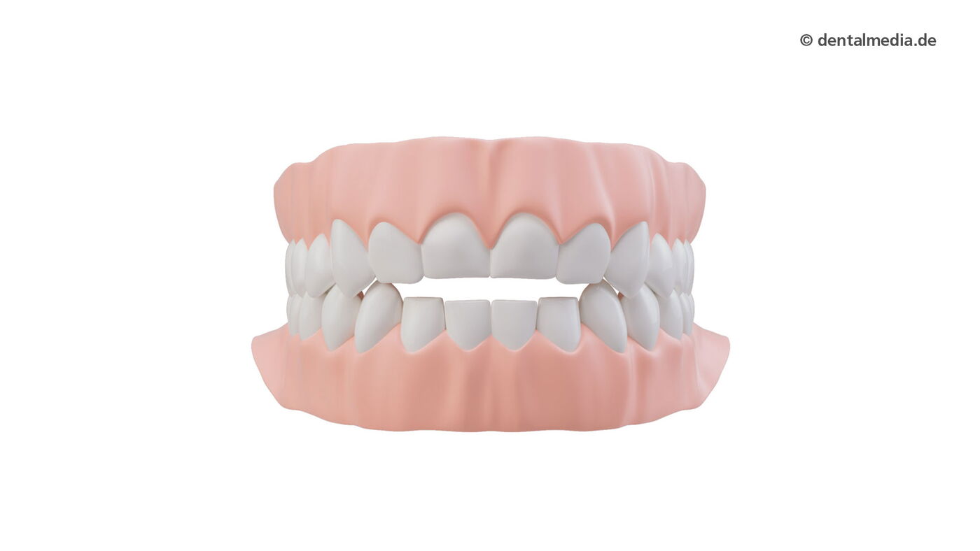 Die Zahnspange für Erwachsene: JOLA Aligner